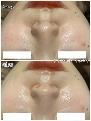 ENCHANT 脱毛.小顔.毛穴のエステ・リラクイメージ