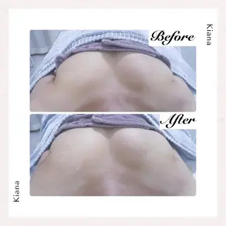 【バスト専門店 】 Kiana のエステ・リラクイメージ
