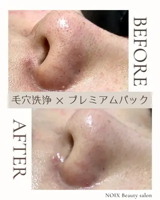 NOIXbeauty salonの眉毛・アイブロウイメージ