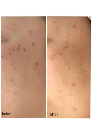 毛穴シミ改善専門 サロンド・ルパークのエステ・リラクイメージ