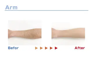 セルフ脱毛/美尻イス キングスサロン熊本のエステ・リラクイメージ