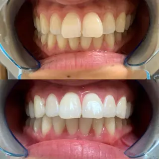 藤本 真心のネイルデザイン