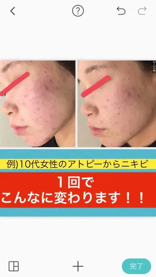 ショート カラー パーマ ヘアアレンジ メンズ キッズ ネイル マツエク・マツパ ニキビ・肌質改善専門 ♡人生が変わるサロンのエステ・リラクイメージ