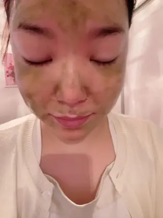 フェアリーローズ所属・fairyrose organicエステのエステ・リラクイメージ