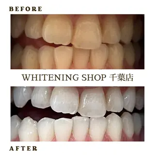 メンズ ホワイトニング ショップ千葉店のその他イメージ