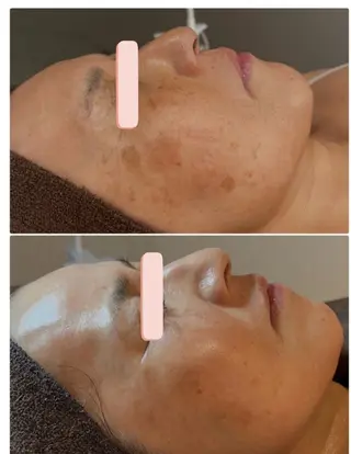 メディカルビューティーSalon Links所属・稲木 俊子のエステ・リラクイメージ