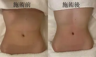 WOM SALON所属・MIKU【美容整形ダ ウンタイムケア銀座】のエステ・リラクイメージ