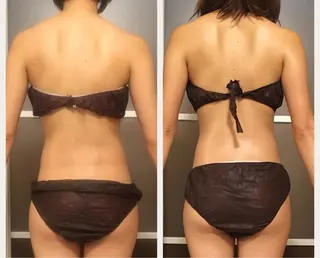 ショート カラー パーマ ヘアアレンジ メンズ キッズ ネイル マツエク・マツパ アニメ,Vオタク× 即効痩せエステサロンのエステ・リラクイメージ