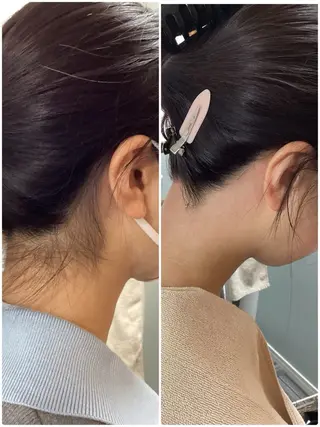 HUG🐰ワックス 脱毛 ホワイトニングのエステ・リラクイメージ