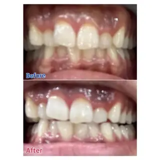 M渋谷店所属・Ｍ渋谷 ホワイトニングのエステ・リラクイメージ