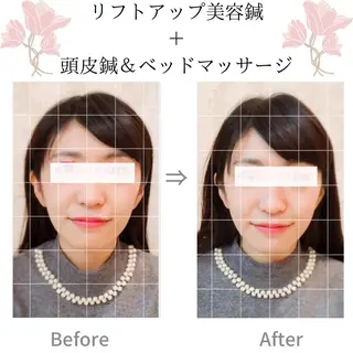 美容鍼サロン    Fleurir所属・伊藤 かなえのエステ・リラクイメージ