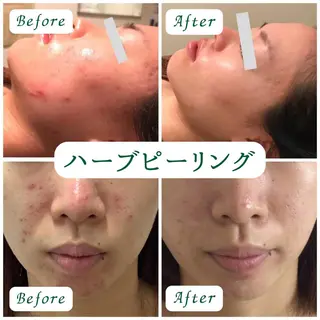 美容鍼・整体サロン アネモネ🌸心斎橋のエステ・リラクイメージ