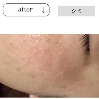 beauty CHOOSEのマツエク・マツパデザイン