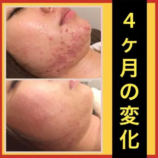 ミディアム カラー パーマ ヘアアレンジ メンズ キッズ ネイル マツエク・マツパ ニキビ・肌質改善専門 ♡人生が変わるサロンのエステ・リラクイメージ