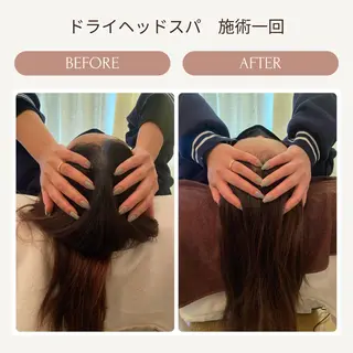 ハーブピーリング🌿 脱毛🧡ヘッドスパのエステ・リラクイメージ