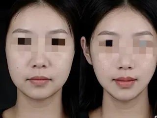 aliaハイフ&水光ジェットサロン所属・aliaハーブ水光店 エステティシャン募集のエステ・リラクイメージ