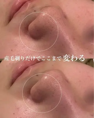 Ele所属・有田 佑佳のエステ・リラクイメージ