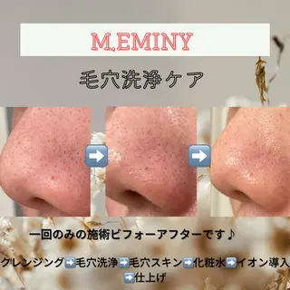 脱毛 &relaxation　M.EMINY所属・大分賀来リラクサロン M.EMINYのエステ・リラクイメージ