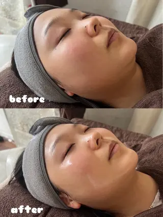 リンパ×ハーブ蒸し TIARA.烏丸三条のエステ・リラクイメージ