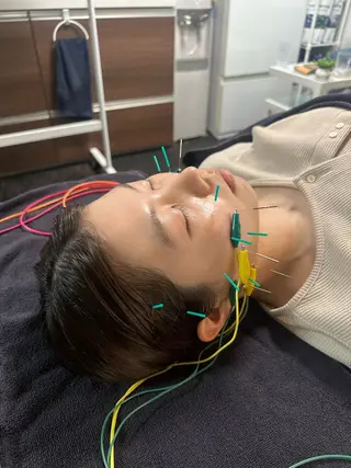 小顔矯正・美容鍼 FLOW鍼灸整体院のエステ・リラクイメージ