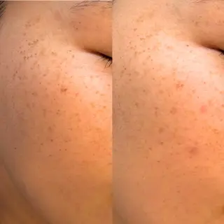 AIMER所属・AIMER アイブロウ／エステのネイルデザイン