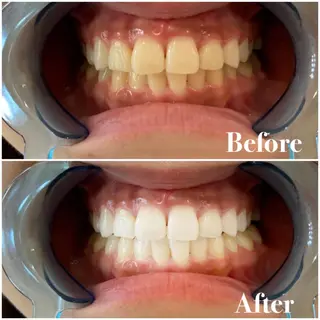 セミロング パーマ キッズ アイブロウ マツエク・マツパ メンズ カラー ヘアアレンジ ネイル ライトビューティー 銀座店のエステ・リラクイメージ