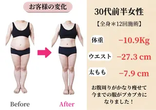 Belle White所属・本格痩身＊肌質改善＊ BelleWhiteのエステ・リラクイメージ