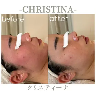 肌質改善|天王寺 For...はるかのエステ・リラクイメージ