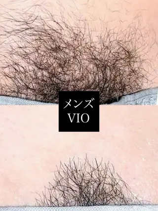 Hit. シュガーリング豊橋のエステ・リラクイメージ