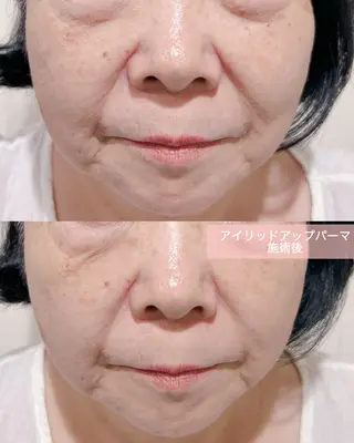 マツエク・マツパ merveilles所属・まつげ/整体/にきび ・アトピー専門サロンのマツエク・マツパデザイン