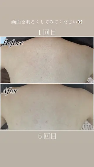 都度払い制脱毛サロンBe Charm所属・Be Charm 山﨑のエステ・リラクイメージ