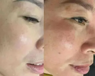 マツエク・マツパ aliaハイフ&水光ジェットサロン所属・aliaハーブ水光店 エステティシャン募集のエステ・リラクイメージ