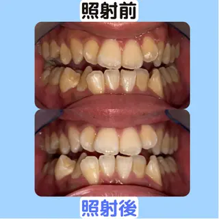 ホワイトニング｜韓国式3D毛穴洗浄 lonhana ﾛﾝﾊﾅ所属・韓国式3D毛穴洗浄 lonhanaのその他イメージ