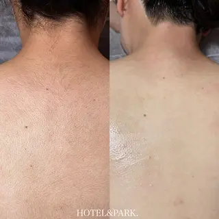 HOTEL&PARK .Moeワックス脱毛のエステ・リラクイメージ