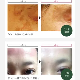 LEA MUSASHIKOSUGI所属・美肌育成サロン LEA武蔵小杉のエステ・リラクイメージ