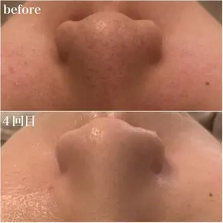 ララ/ハーブ メゾンリュバンのエステ・リラクイメージ