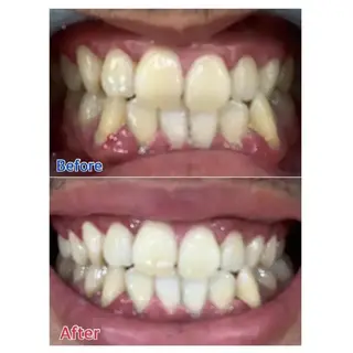 M渋谷店所属・Ｍ渋谷 ホワイトニングのエステ・リラクイメージ