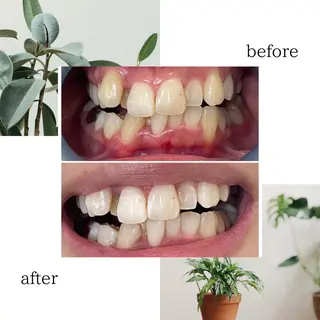 脱毛専門サロンELIXIR（ｴﾘｸｻｰ）所属・脱毛&ホワイトニング ELIXIR×ULTのエステ・リラクイメージ