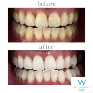 メンズ キッズ ホワイトニングショップ町田店所属・ホワイトニング ショップ町田店のその他イメージ