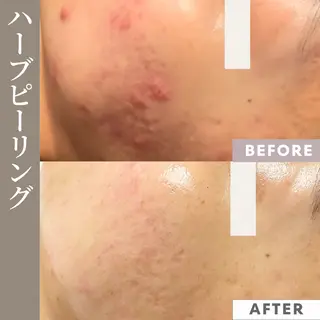 【フェムケア専門店】 PEQLIAヒロミのエステ・リラクイメージ