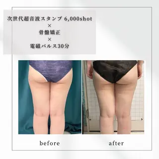 小顔矯正専門店 【RED】池田のエステ・リラクイメージ