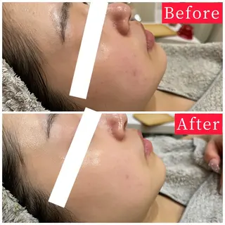 ハーブピーリング専門 muro.のエステ・リラクイメージ