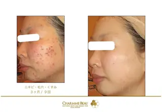 Facial Salon.NANIのエステ・リラクイメージ