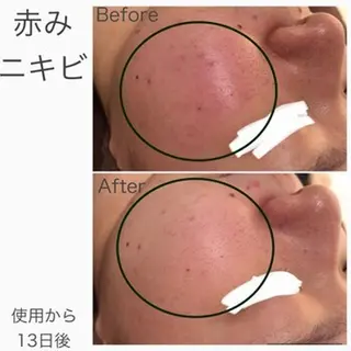 触れたくなる モテ肌へ...❤︎のエステ・リラクイメージ