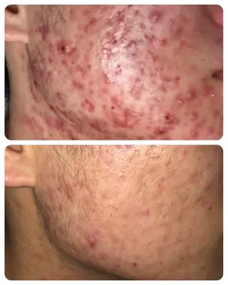 Lussera(ルセラ)所属・肌質を変えて すっぴん肌に✨のその他イメージ