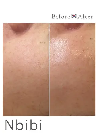 韓国🇰🇷価格 サロン_Nbibiのエステ・リラクイメージ