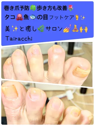 ネイル Tairacchi ﾀｲﾗｯﾁのエステ・リラクイメージ