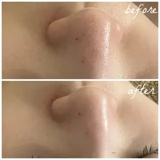 メンズ メナード岐阜茜部 杉浦のエステ・リラクイメージ