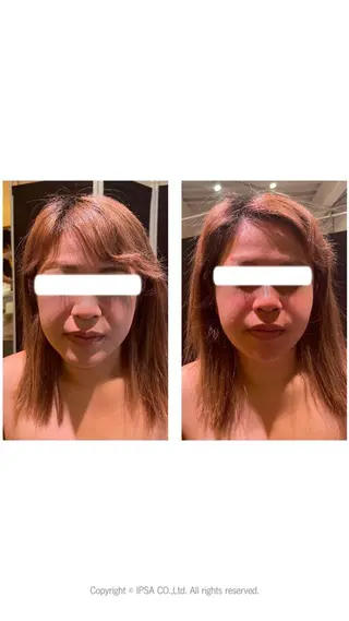 BACI STYLE所属・寧♡ 美肌小顔・ボディケアのエステ・リラクイメージ