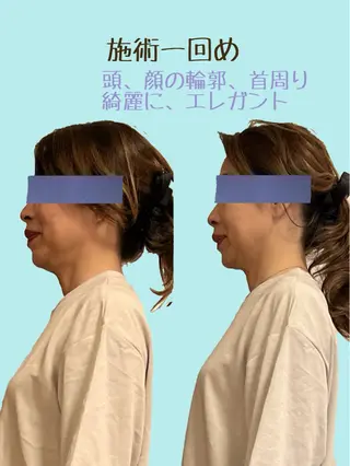 Anne’s happyBonesのエステ・リラクイメージ